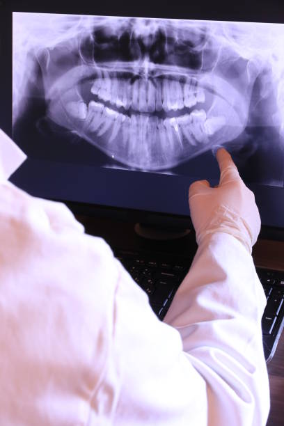 Best Emergency Dental Surgery in Arvin, CA